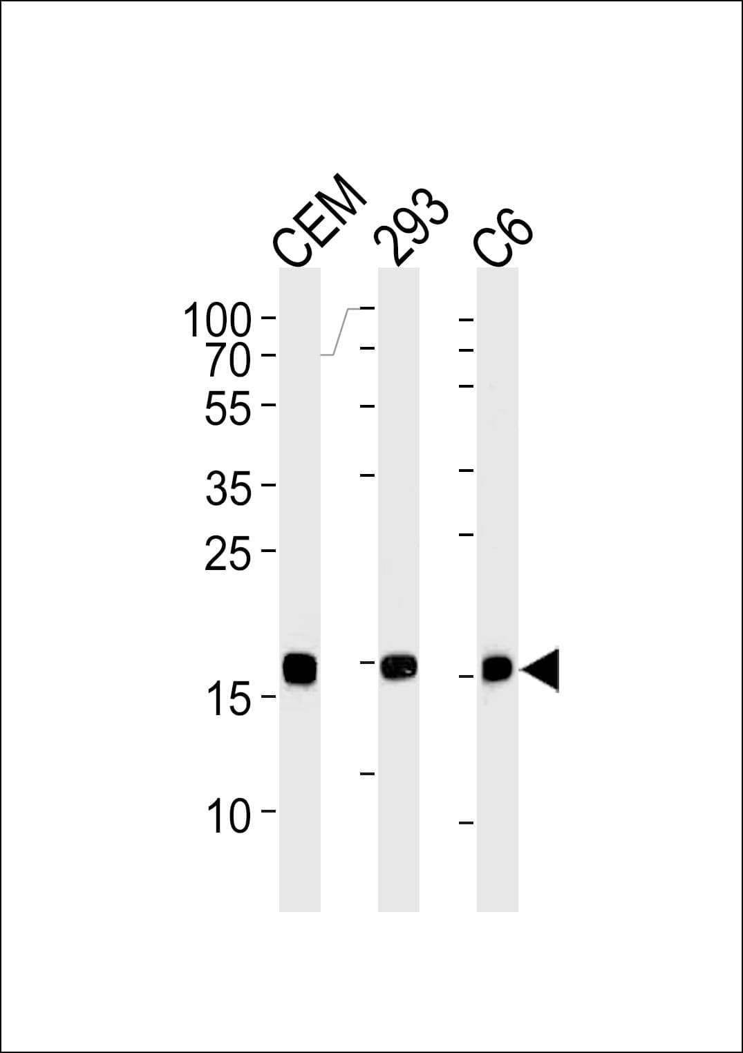 Monoclonal Mouse anti-Human SUMO2 Antibody (clone 973CT8.1.1, WB)