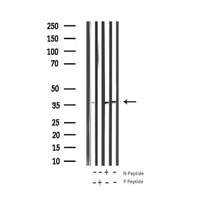 STX1A / Syntaxin 1A Antibody (phospho-Ser14)