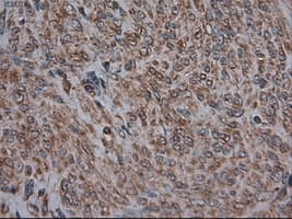 Monoclonal Mouse anti-Human CPA1 / Carboxypeptidase A Antibody (clone OTI2A3, IHC, IF, WB)