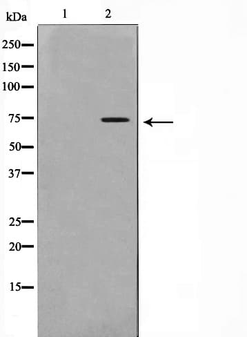 RELA / NFKB p65 Antibody (phospho-Ser311)