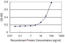 Monoclonal Mouse anti-Human TCN2 Antibody (clone 2F4, WB)