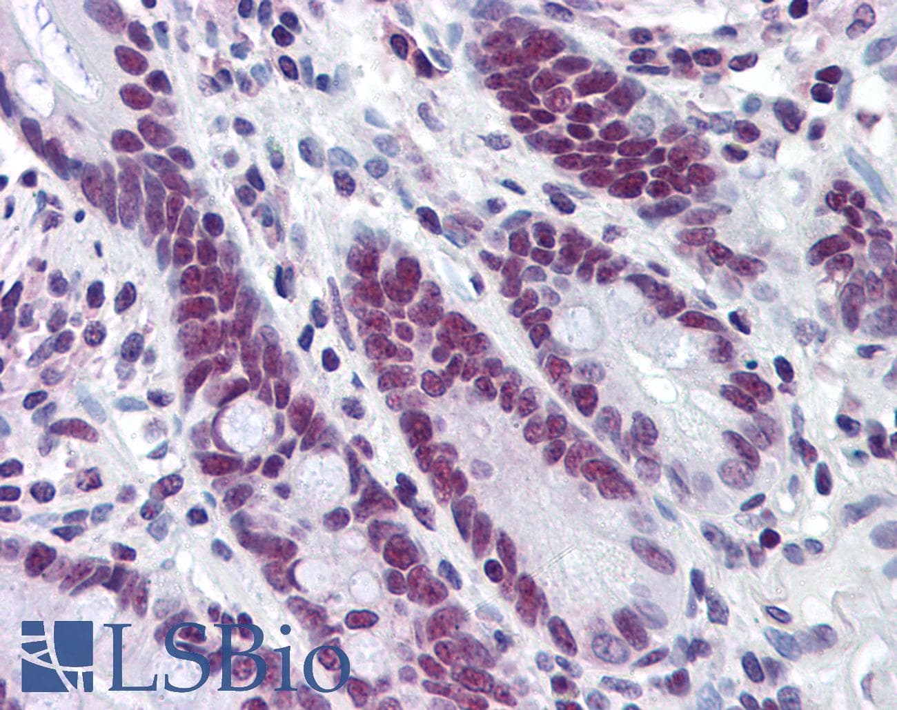 IHC-plus™ Monoclonal Mouse anti-Human HDAC1 Antibody (clone 3E1, IHC, IF, WB)
