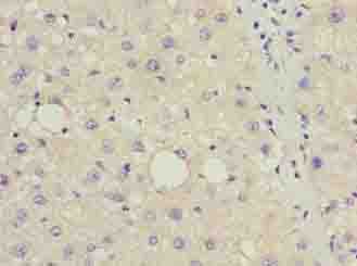 DDIT3 / CHOP Antibody