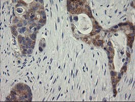 RIOK2 Antibody (aa277-552, clone OTI5D11, Carrier-free)