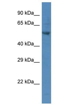 Polyclonal Rabbit anti-Human PARP2 Antibody (aa481-530, WB)