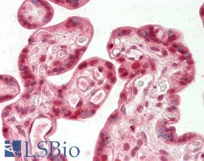 IHC-plus™ Polyclonal Rabbit anti-Human CDC42 Antibody (IHC, WB)