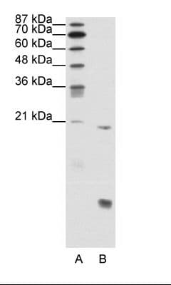 AML1 / RUNX1 Antibody (N-Terminus)