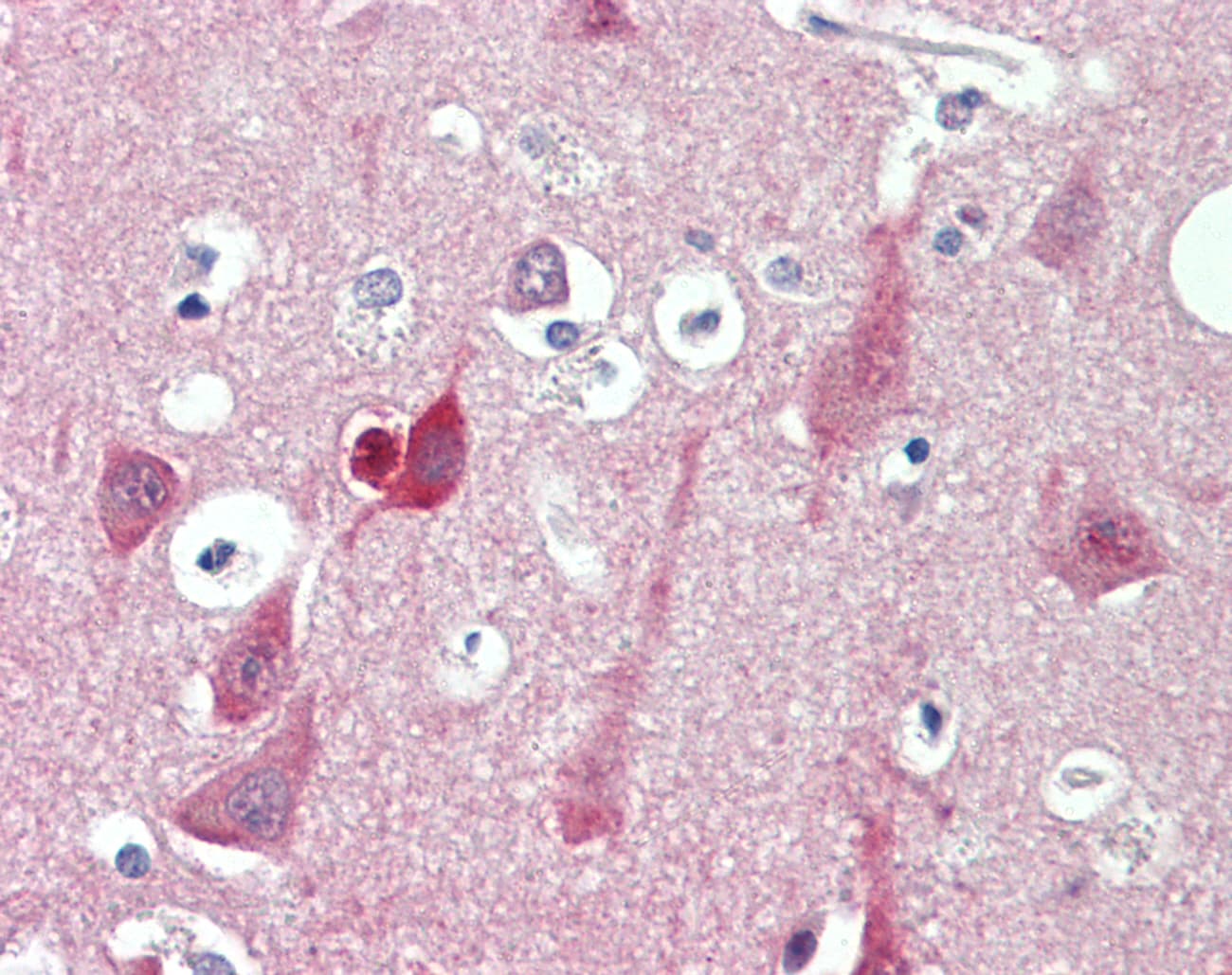 Polyclonal Rabbit anti-Human ST3GAL2 Antibody (C-Terminus, IHC, WB)