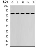 DHTKD1 Antibody