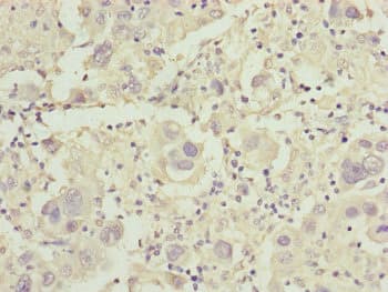 CDO1 / Cysteine Dioxygenase Antibody