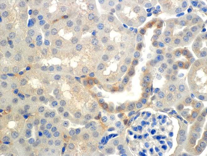 SCNN1B / ENaC Beta Antibody (clone 7B8, FITC)