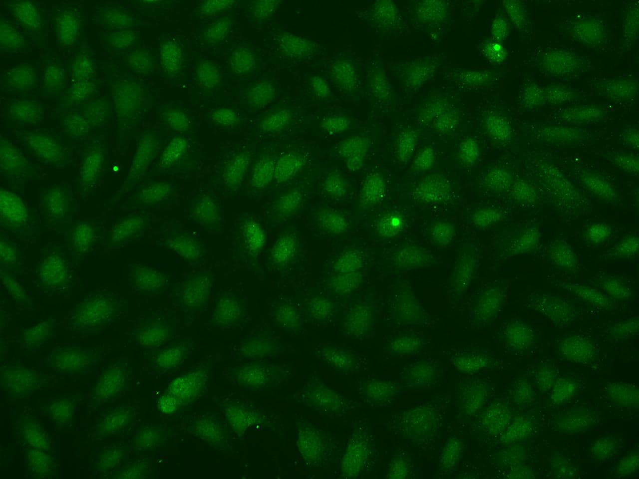 SMMHC / MYH11 Antibody