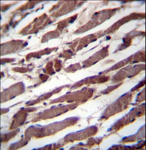 Polyclonal Rabbit anti-Human PUS1 Antibody (aa322-350, IHC, WB)