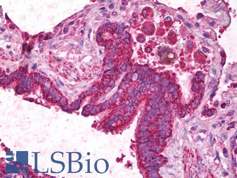 IHC-plus™ ANGPT1 / Angiopoietin-1 Antibody (aa76-85)