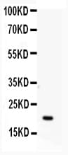 APRT Antibody (aa5-49)