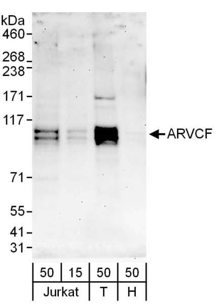 ARVCF Antibody (aa75-125)