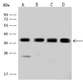 Polyclonal Rabbit anti-Human PDLIM1 Antibody (WB)