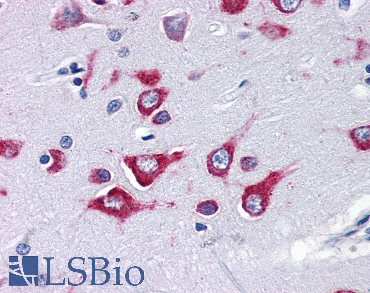 IHC-plus™ Kinesin 5A / KIF5A Antibody