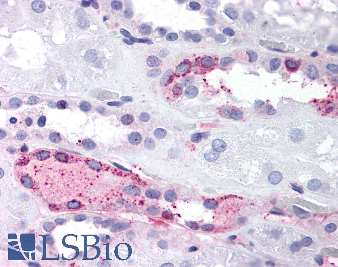 IHC-plus™ LPAR4 / GPR23 Antibody (C-Terminus)