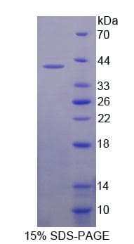 Human APBB1 / FE65 Protein (Recombinant His, N-Terminal)