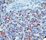 MYOG / Myogenin Antibody (clone F5D)
