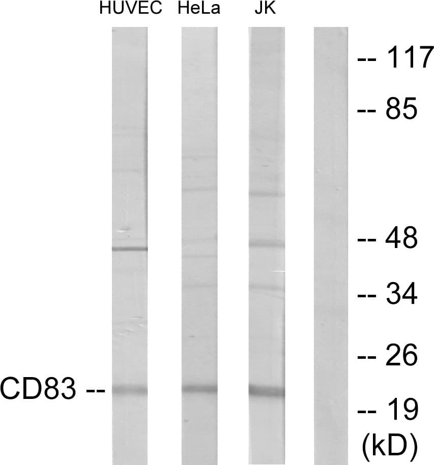CD83 Antibody (aa101-150)