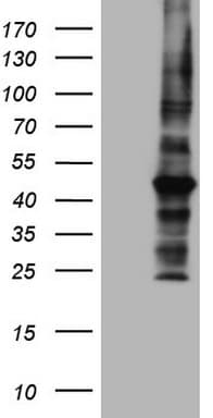 MTOR Antibody (aa1766-2144, clone OTI5B1)