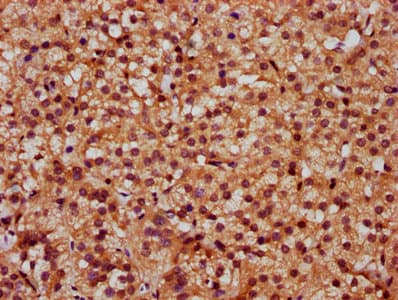 SLC26A2 Antibody