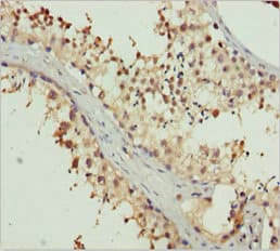 SPFH2 / ERLIN2 Antibody