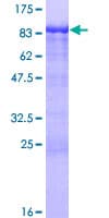 Human CCDC6 Protein (Recombinant GST)