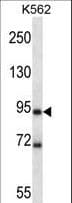 Polyclonal Rabbit anti-Mouse MARK1 / MARK Antibody (aa600-627, WB)