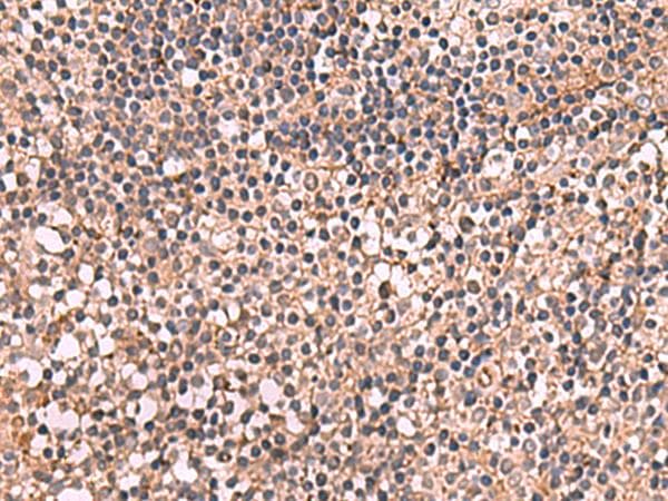 NOTCH4 Antibody