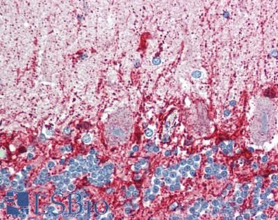 IHC-plus™ Polyclonal Rabbit anti-Human GLUD2 Antibody (aa319-558, IHC, WB)