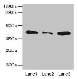 IHC-plus™ SGCA / DAG2 Antibody