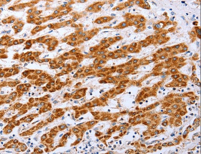 CLDN10 / Claudin 10 Antibody