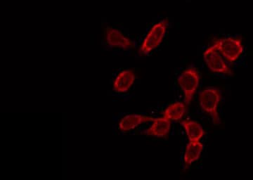 GK2 / Glycerol Kinase 2 Antibody
