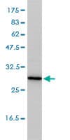 TPMT Antibody (clone 1B5)