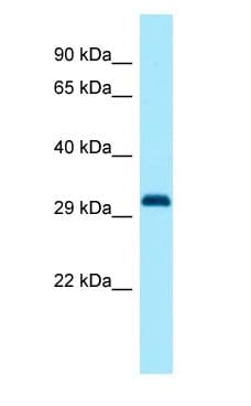 DLX1 Antibody (C-Terminus)