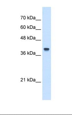 IFI44L Antibody (N-Terminus)