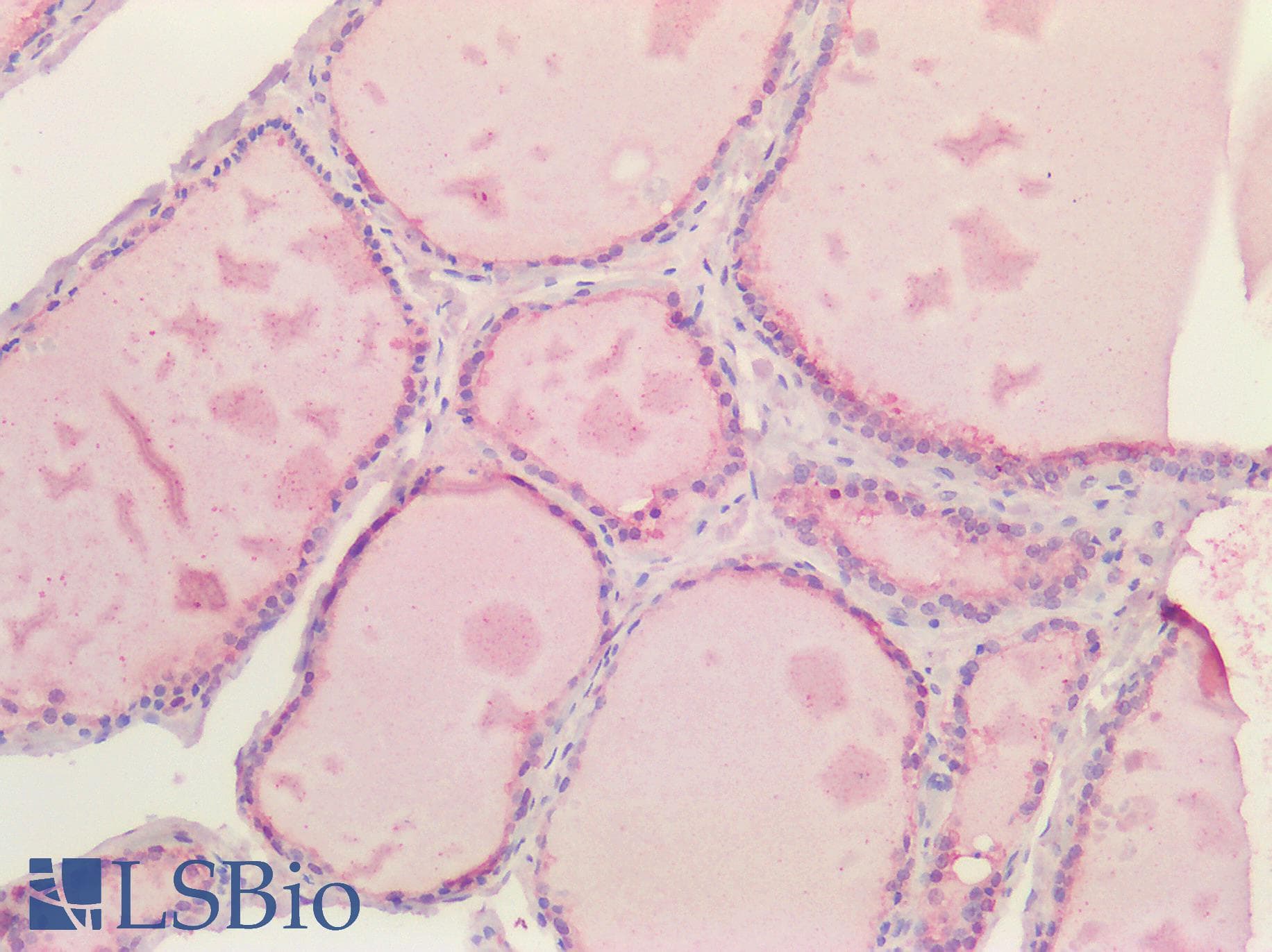 IHC-plus™ PRDX1 / Peroxiredoxin 1 Antibody (aa106-117)