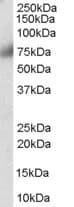 IHC-plus™ FGFR1 / FGF Receptor 1 Antibody (aa837-852)
