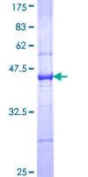 Human Complement C3 Protein (Recombinant GST, N-terminus)
