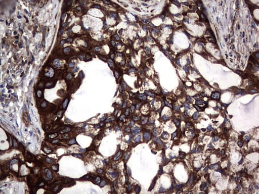KRT7 / CK7 / Cytokeratin 7 Antibody (clone OTI3E5)