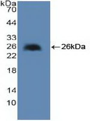 cPLA2 Antibody (aa1-178, APC)