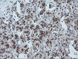 UBE2G2 Antibody (clone OTI1D7)