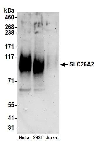 SLC26A2 Antibody (aa1-50)