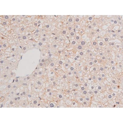 ADD1 / Adducin Alpha Antibody (phospho-Ser726)