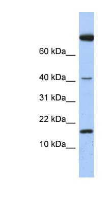 IL4 Antibody (C-Terminus)