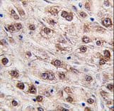 Polyclonal Rabbit anti-Human JMJD4 Antibody (aa423-455, IHC, WB)