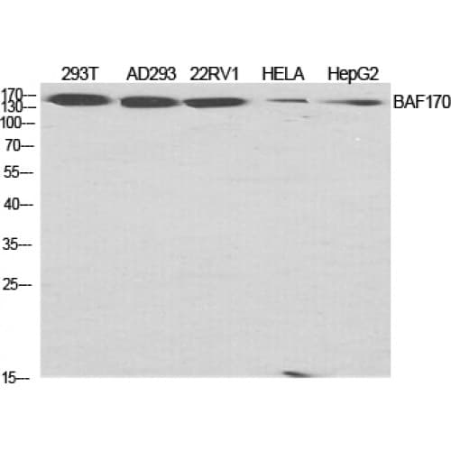 SMARCC2 Antibody (330-410 aa, Internal)